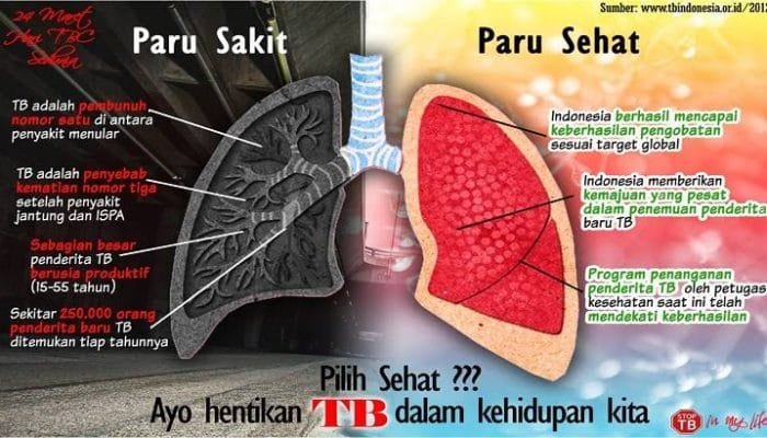 Jangan Anggap Remeh, Serangan Jantung Sering Kasih “Spoiler” Jauh Sebelum Terjadi