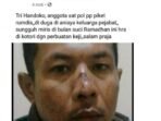 Alamaak, Satpol PP Penjaga di Rumdis Azwar Hadi Diduga Jadi Korban Penganiayaan