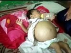 Balita 10 Bulan di Talangpadang, Butuh Uluran Tangan Dermawan