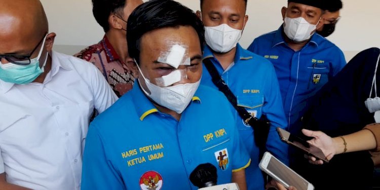 Haris Pertama Ketua Umum DPP KNPI saat diwawancara terkait pemukulan terhadap dirinya pada Senin 21 feb 2022