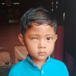 Anak Penderita Katarak di Talang Padang Butuh Uluran Tangan Dermawan