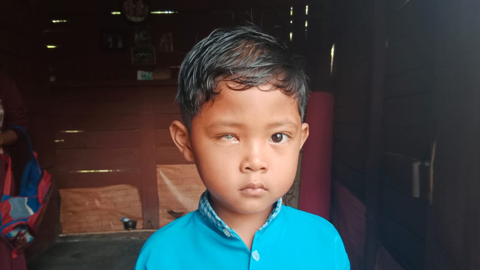 Febri Kurniawan (7) anak pertama dari pasangan Rano dan Nengsih derita katarak sejak umur dua tahun, foto- Nanang