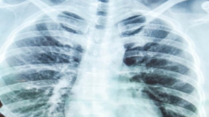 Ilustrasi, Paru-paru