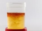 Kenali 7 Penyebab Gumpalan Darah Keluar Bersama Urine, Pahami dan Konsultasikan?