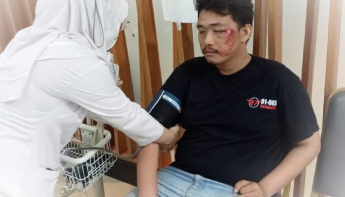 Cekcok dengan WNA, Ketua GMNI Dikeroyok Hingga Babak Belur