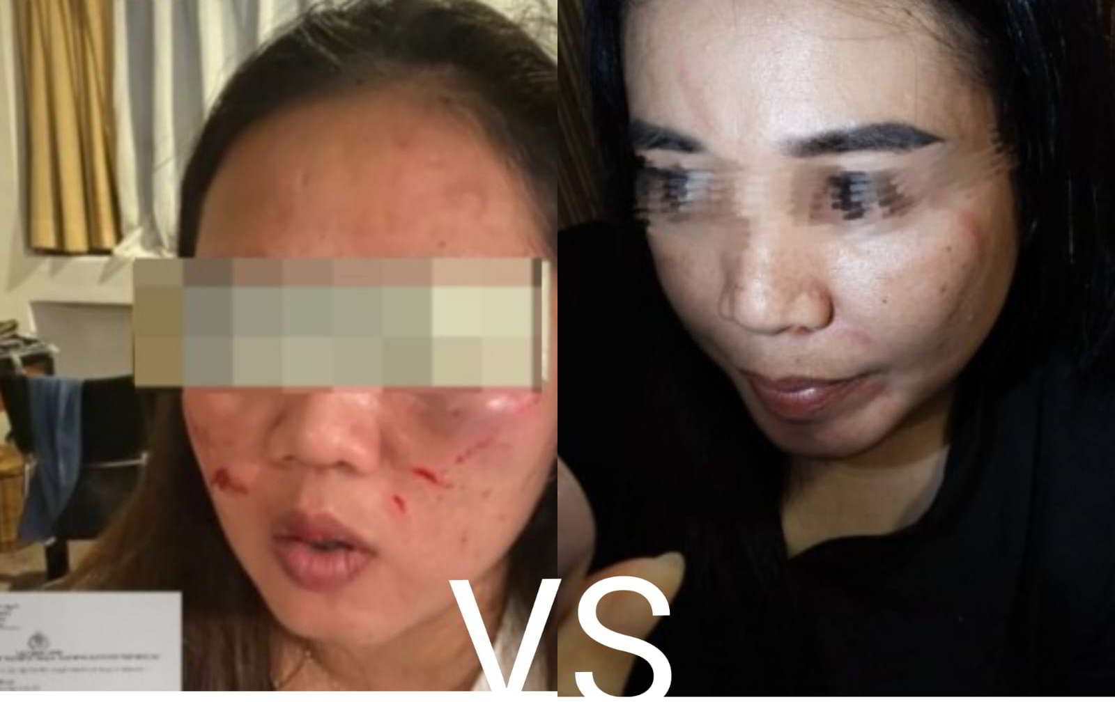 Staf Honorer di lingkungan DPRD Tanggamus cek-cok yang berujung perkelahian hingga saling lapor, Senin 25 Maret 2024- foto doc kolase