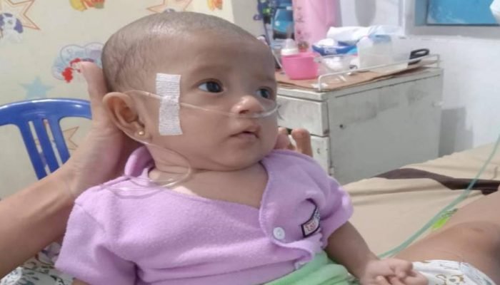 Kasihan Haura Bocah Malang di Wonosobo Tanggamus, Berjuang Melawan Sakit Ditengah Keterbatasan Ekonomi