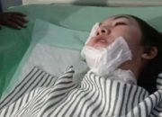 WASPADA! Teror Penyiraman Air Keras Kembali Terjadi di Bekasi