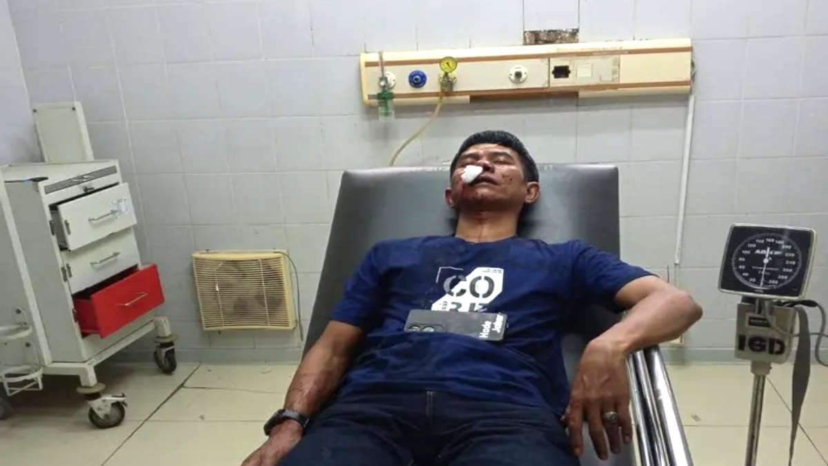 Wartawan di Subang bernama Hadi (46) dari media Hadejabar, mengalami luka parah di kepala dan wajah setelah dikeroyok saat menjalani tugas jurnalistik di Cijambe, 9 April 2025 - foto doc ist.