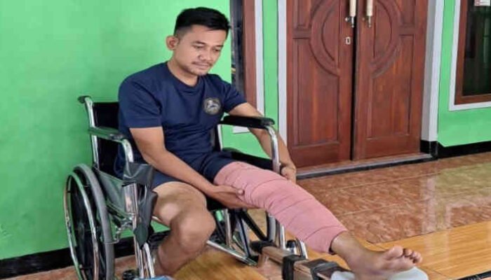 Petugas Damkar Bekasi Alami Patah Tulang Saat Padamkan Api Pabrik, Harap Uluran Tangan Pemerintah