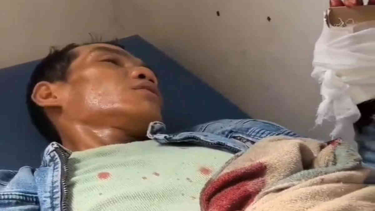 AB Korban pembacokan dengan Sajam oleh Kades Batu Badak HS saat menjalani perawatan medis, dikabarkan kondisinya saat ini Kritis, Senin 7 Juli 2025- foto doc ist