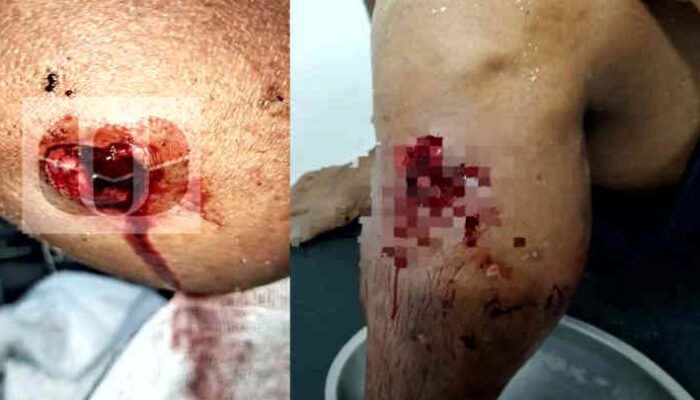 Mencekam! Malam Berdarah di Teluk Semaka, Nelayan Tanggamus Hampir Kehilangan Kaki Ditusuk Ikan Marlin Raksasa