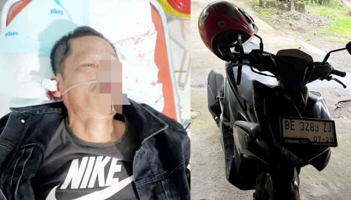 Lubang Jalan di Tanggamus “Menelan” Pengendara, Proyek Tambal Sulam Kok Tambah Malapetaka?