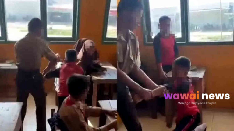 Viral! Siswa SMP di Tulang Bawang Patah Tangan Diduga Jadi Korban Perundungan, Teman-temannya Malah Merekam